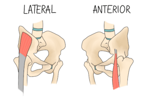 Snapping Hip (lateral and anterior types)