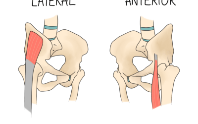 What Are the Four Types of Snapping Hip?